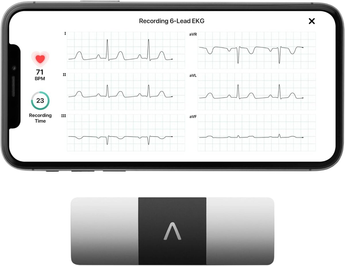 KardiaMobile 6-Lead Personal EKG Monitor  Six Views of The Heart  Detects AFib and Irregular Arrhythmias  Instant Results in 30 Seconds  Works with Most Smartphones - FSA/HSA Eligible - Image 1