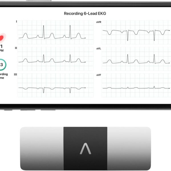 KardiaMobile 6-Lead Personal EKG Monitor  Six Views of The Heart  Detects AFib and Irregular Arrhythmias  Instant Results in 30 Seconds  Works with Most Smartphones - FSA/HSA Eligible