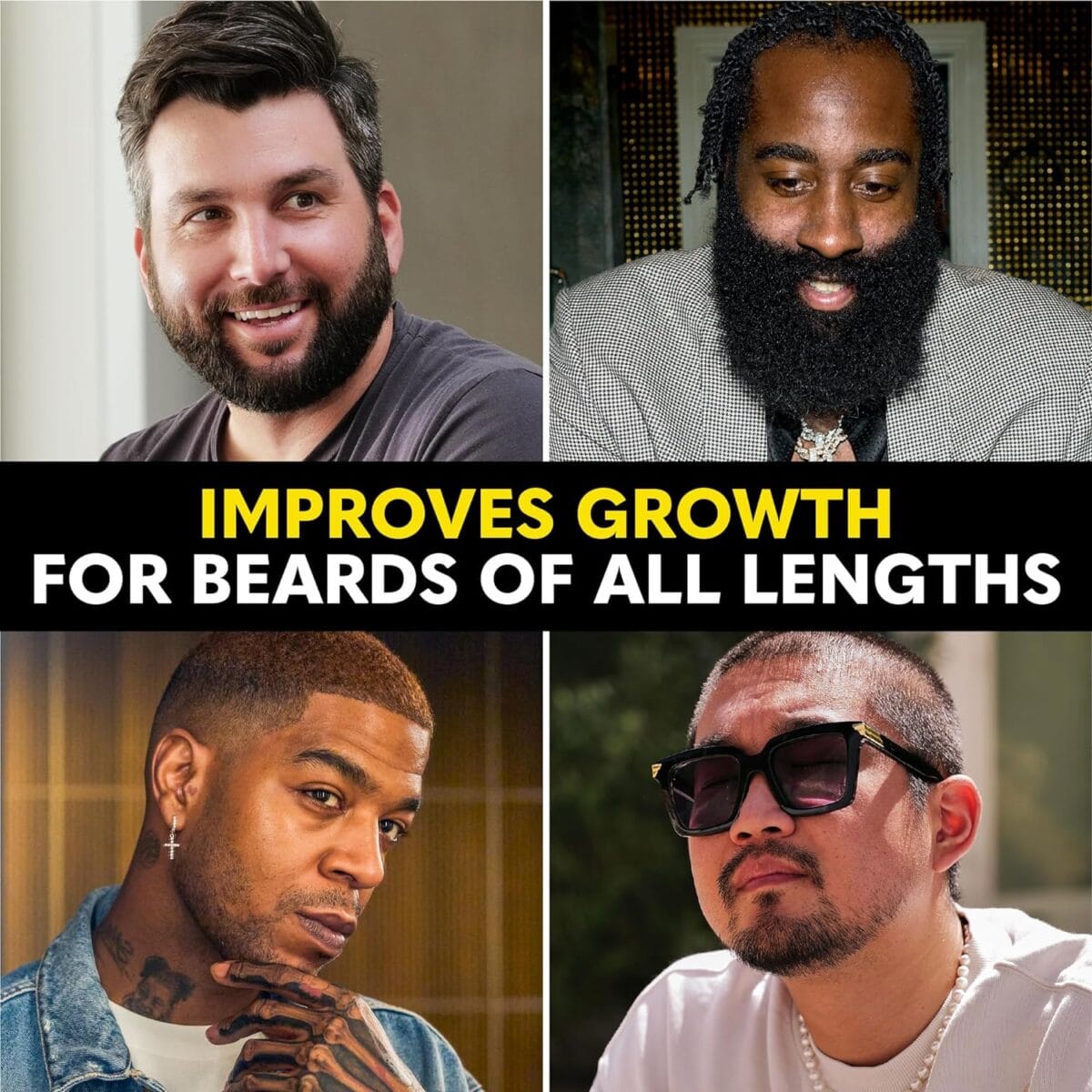 Beard Club – Beard Growth Serum with Natural Castor, Coconut and Avocado to Grow a Thicker, Fuller Beard, Fill in Patches and Stimulate Healthier Facial Hair Growth