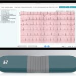 1-Lead Heart Health Monitor at Home, Portable 24 Hours Chest Lead Device with Free AI Analysis & PC Report, Rechargeable Recorder, HHM1