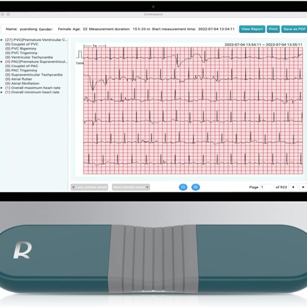 1-Lead Heart Health Monitor at Home, Portable 24 Hours Chest Lead Device with Free AI Analysis & PC Report, Rechargeable Recorder, HHM1